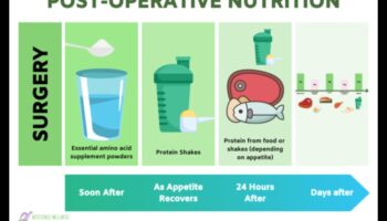 Proteine ​​și recuperare post-operatorie: îmbunătățirea vindecării